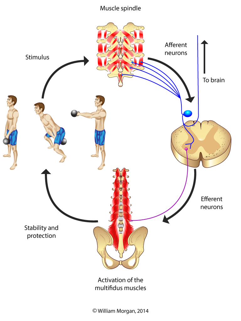 Combined neuromuscular electrical stimulation with motor control exercise  can improve lumbar multifidus activation in individuals with recurrent low back  pain