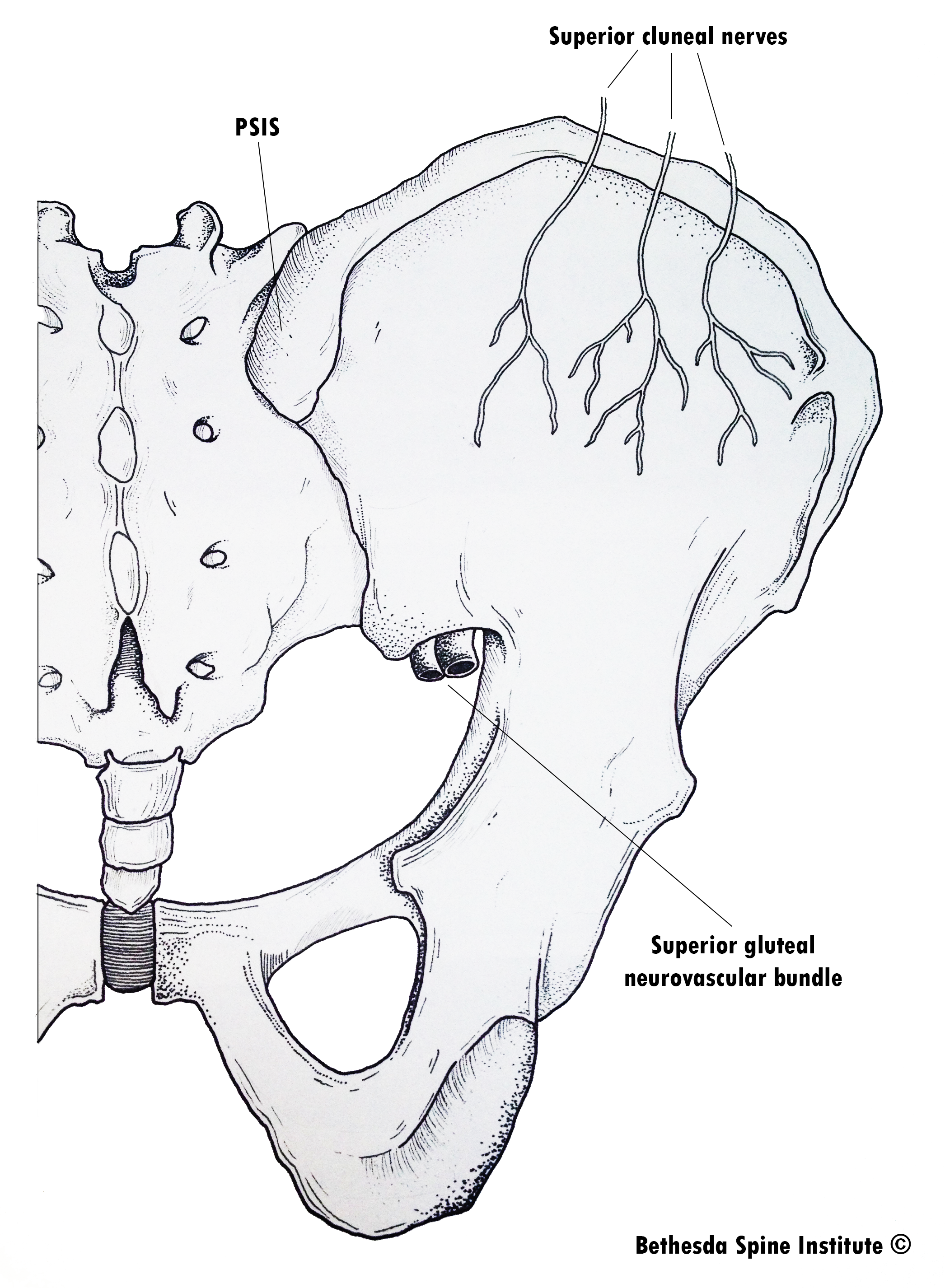 Cluneal Nerve